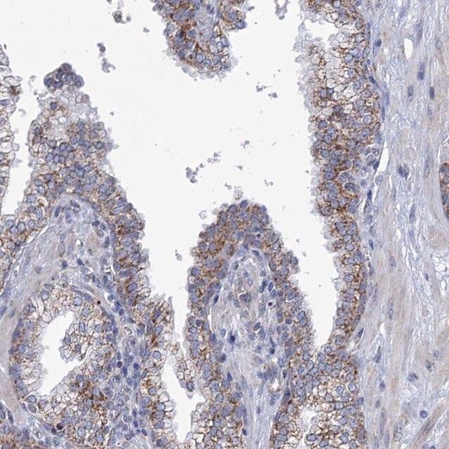 Anti-NDUFC2 antibody produced in rabbit