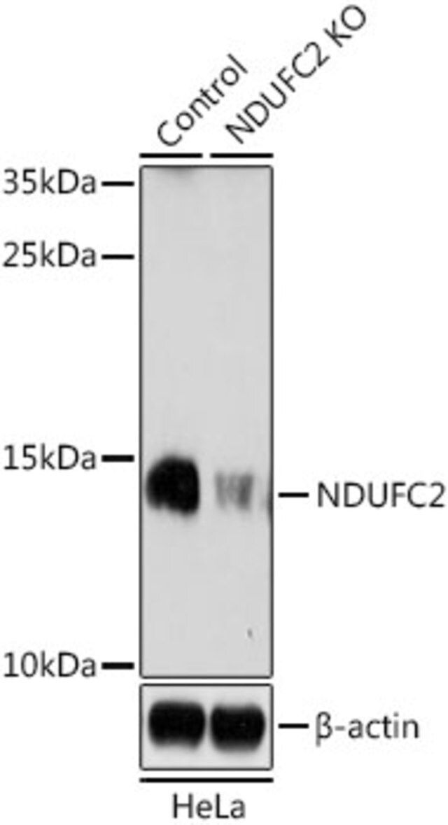 Anti-NDUFC2 antibody produced in rabbit