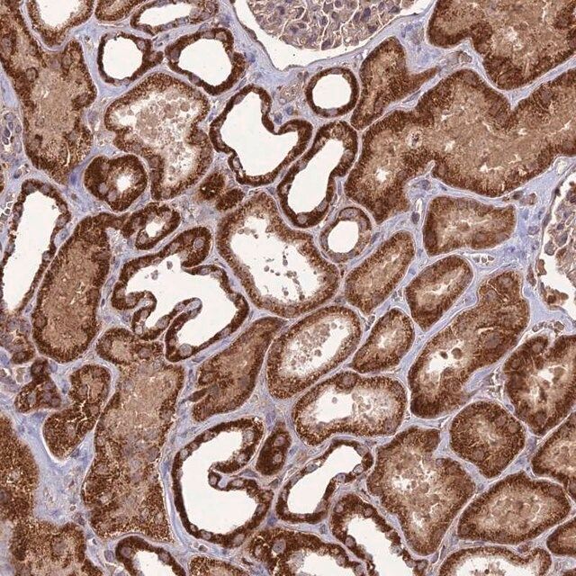 Anti-NDUFC1 antibody produced in rabbit
