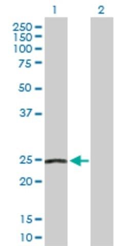 Anti-NDUFS8 antibody produced in rabbit