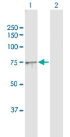 Anti-NDUFS1 antibody produced in rabbit