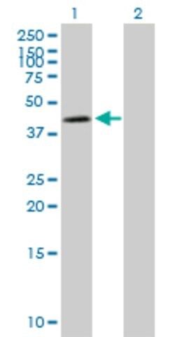 Anti-NDUFS2 antibody produced in mouse