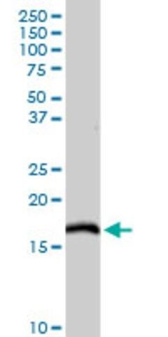 Anti-NDUFC2 antibody produced in rabbit