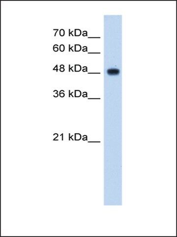 Anti-NDUFV1