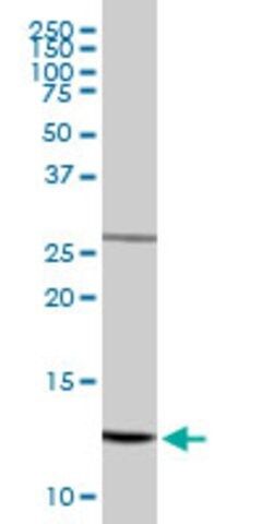 Anti-NDUFS5 antibody produced in rabbit
