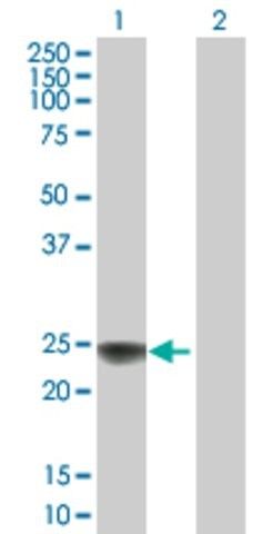 Anti-NDUFS8 antibody produced in mouse