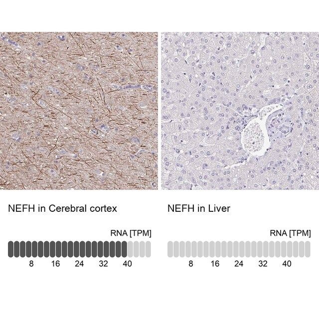 Anti-NEFH antibody produced in rabbit