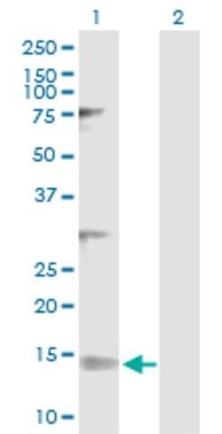 Anti-NDUFV3 antibody produced in rabbit