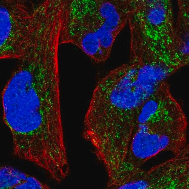 Anti-NDUFS1 antibody produced in rabbit