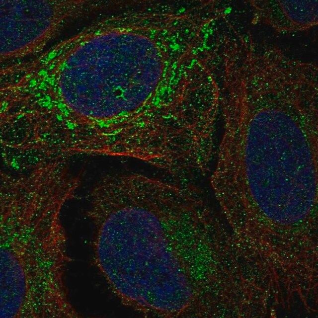 Anti-NDUFV2 antibody produced in rabbit