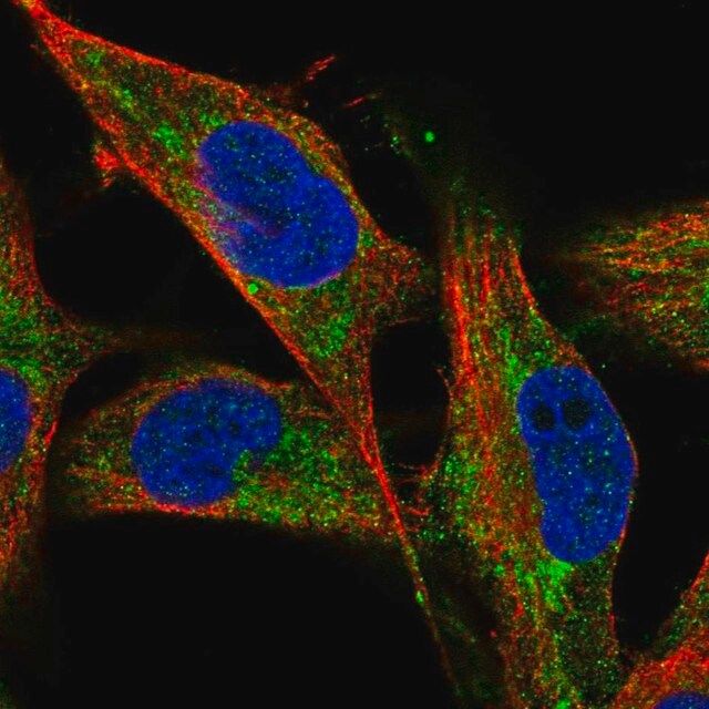 Anti-NDUFV1 antibody produced in rabbit