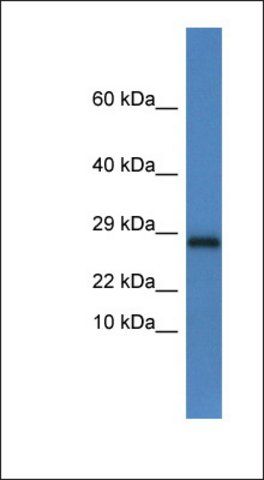 Anti-NDUFV2 antibody produced in rabbit