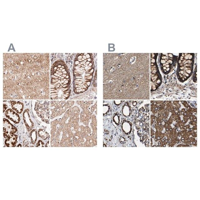Anti-NDUFV3 antibody produced in rabbit