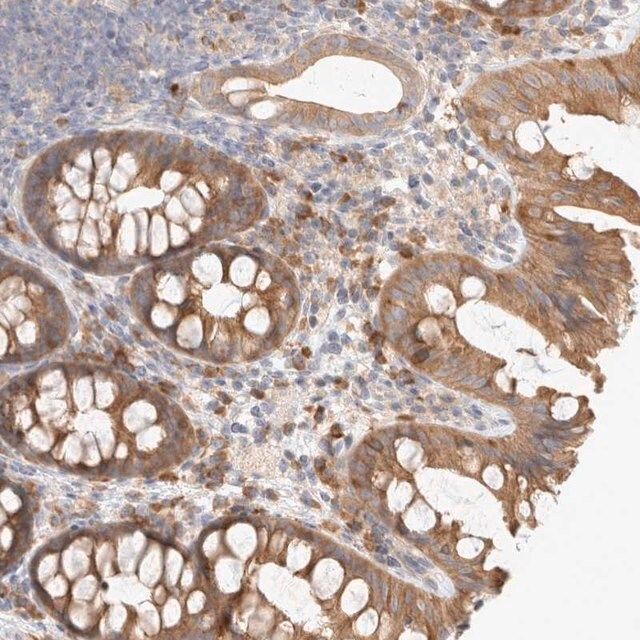 Anti-NEDD4L antibody produced in rabbit