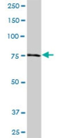 Anti-NDUFS1 antibody produced in mouse