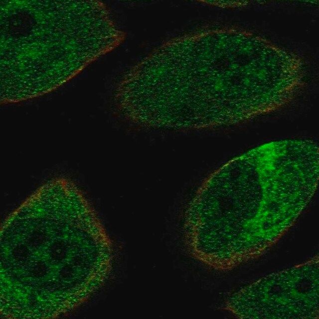 Anti-NEFL antibody produced in rabbit