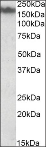 Anti-NEFM antibody produced in goat