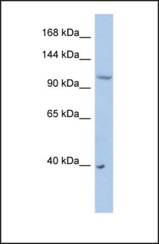 Anti-NEDD4L antibody produced in rabbit