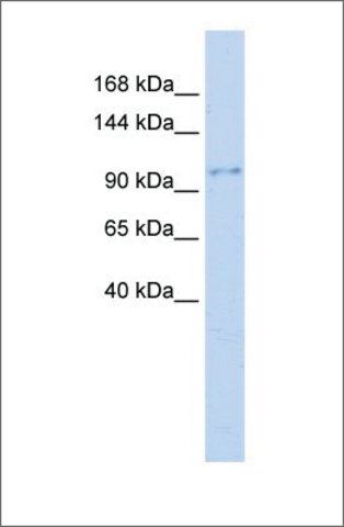 Anti-NEDD4 antibody produced in rabbit