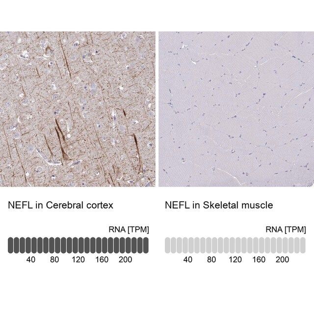 Anti-NEFL antibody produced in rabbit