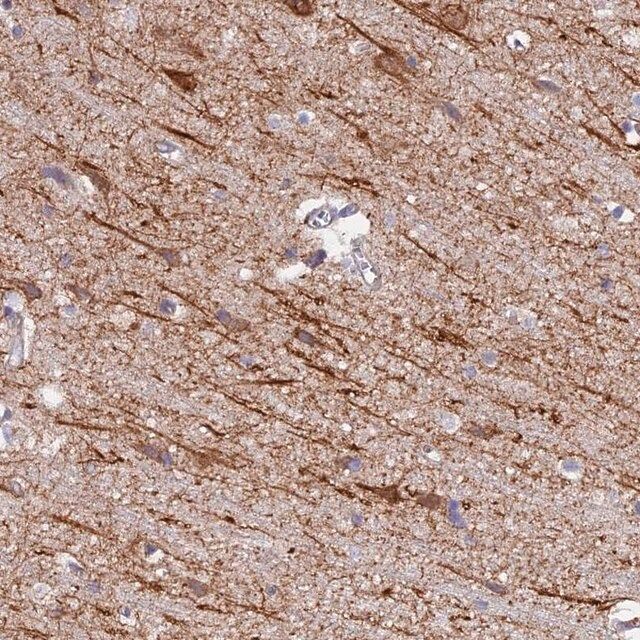 Anti-NEDD4 antibody produced in rabbit