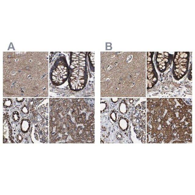 Anti-NDUFV3 antibody produced in rabbit