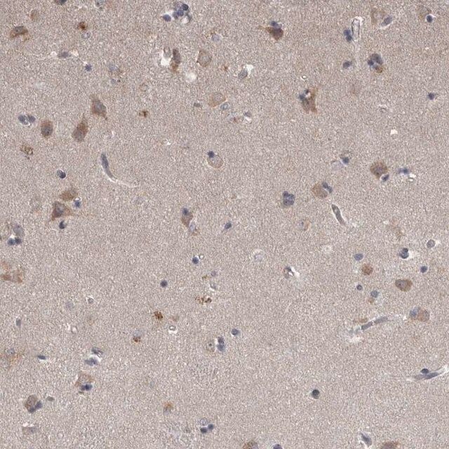 Anti-NENF antibody produced in rabbit