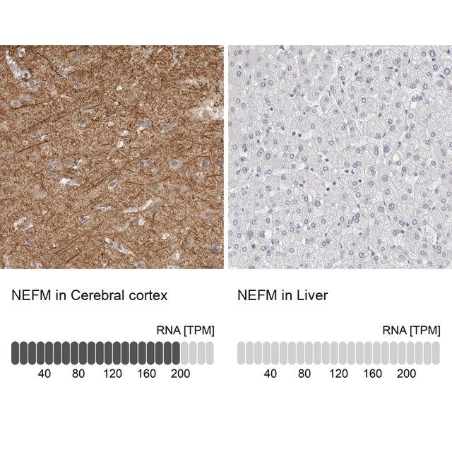 Anti-NEFM antibody produced in rabbit