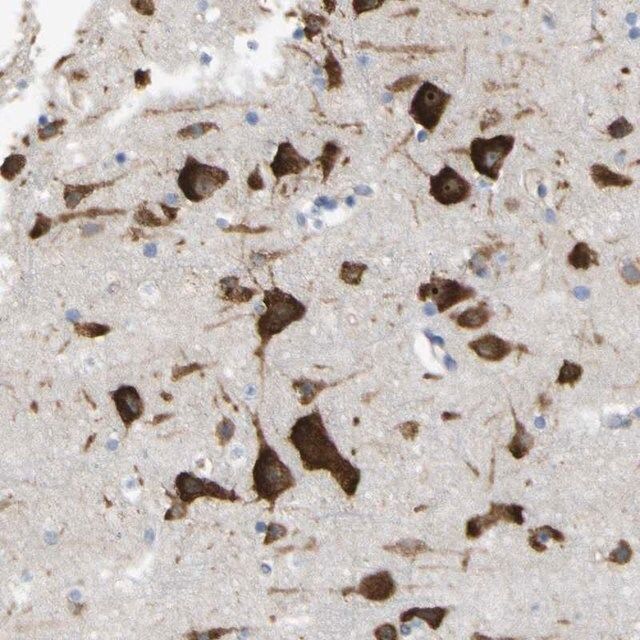 Anti-MYEOV antibody produced in rabbit