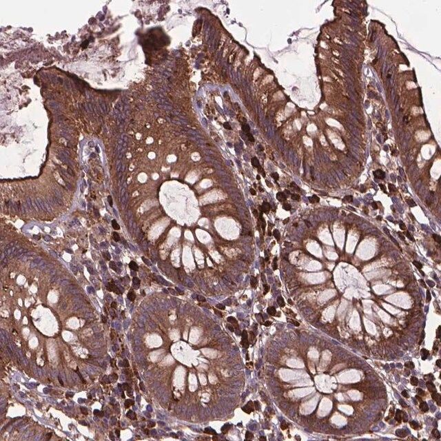 Anti-MYH14 antibody produced in rabbit