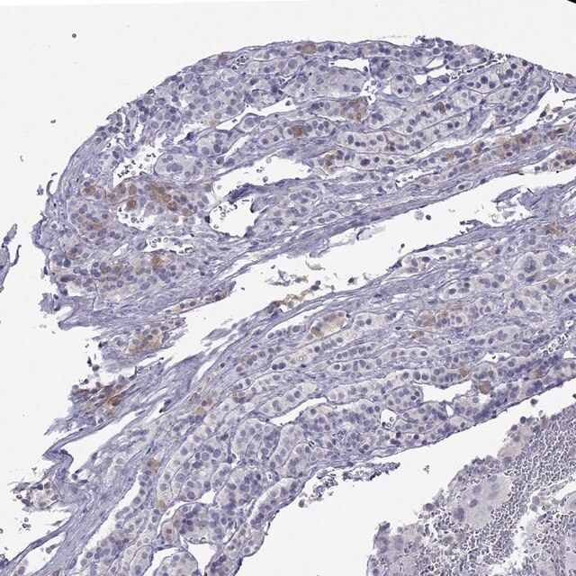 Anti-MYO15A antibody produced in rabbit