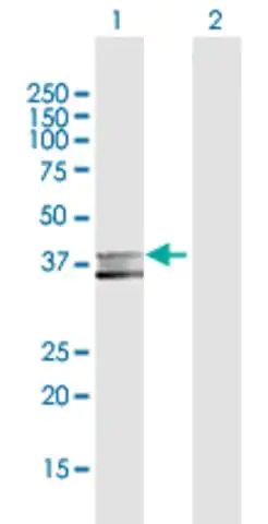 Anti-MPPE1 antibody produced in rabbit
