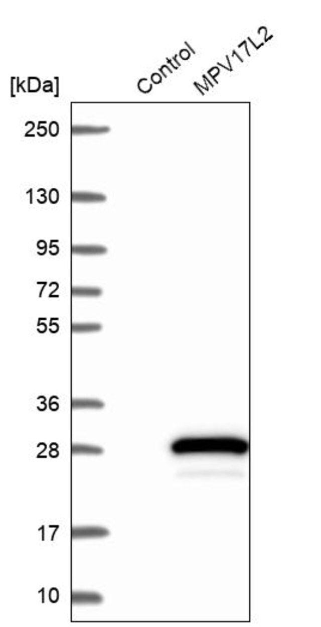 Anti-MPV17L2 antibody produced in rabbit