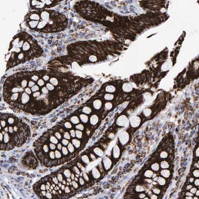 Anti-MRPL12 antibody produced in rabbit