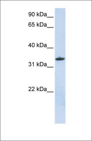 Anti-MRPL15 antibody produced in rabbit