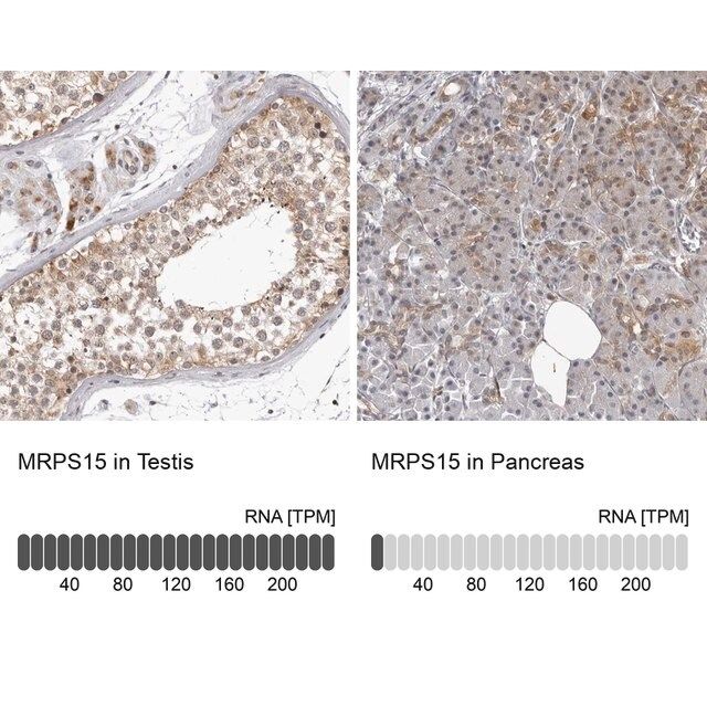 Anti-MRPS15 antibody produced in rabbit