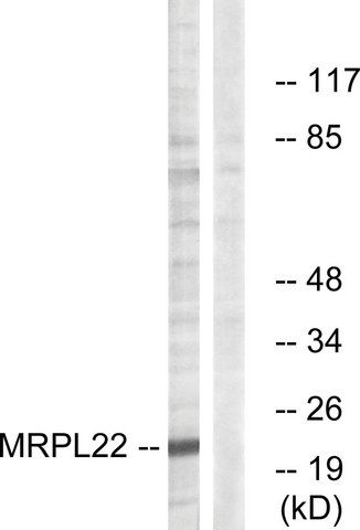 Anti-MRPL22 antibody produced in rabbit