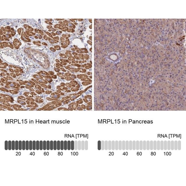 Anti-MRPL15 antibody produced in rabbit