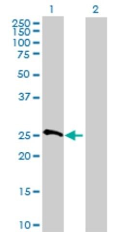 Anti-MRPS10 antibody produced in mouse