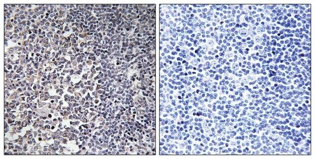 Anti-MRPS16 antibody produced in rabbit