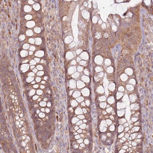 Anti-MRPS6 antibody produced in rabbit