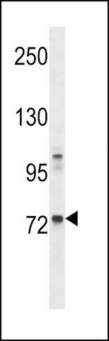 ANTI-MOUSE TEC (CENTER) antibody produced in rabbit