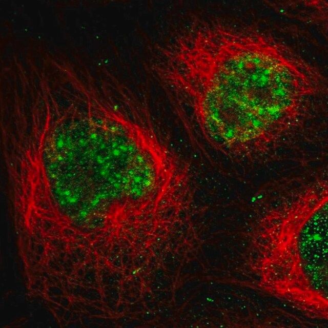 Anti-MPP1 antibody produced in rabbit