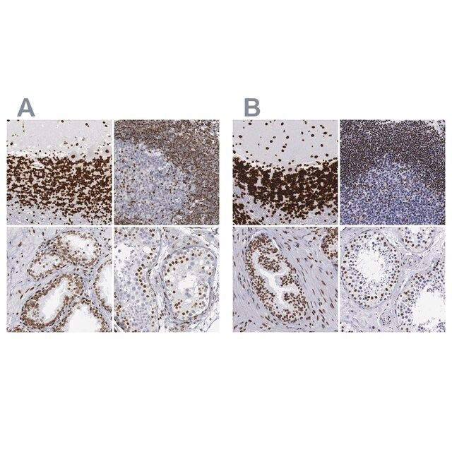 Anti-MeCP2 antibody produced in rabbit