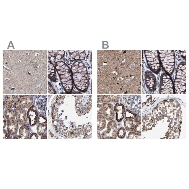 Anti-MECR antibody produced in rabbit