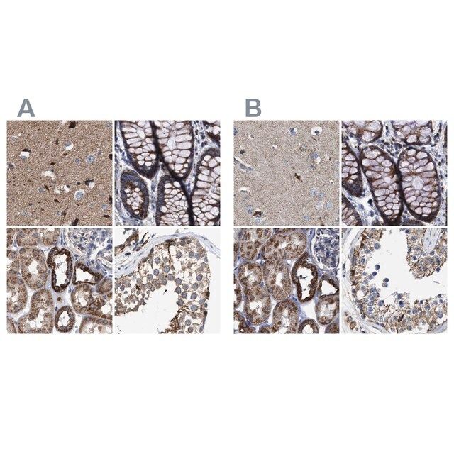 Anti-MECR antibody produced in rabbit