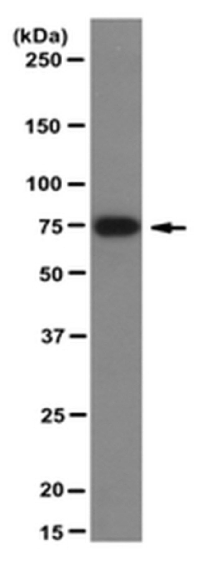 Anti-MeCP2 Antibody, clone 4H7
