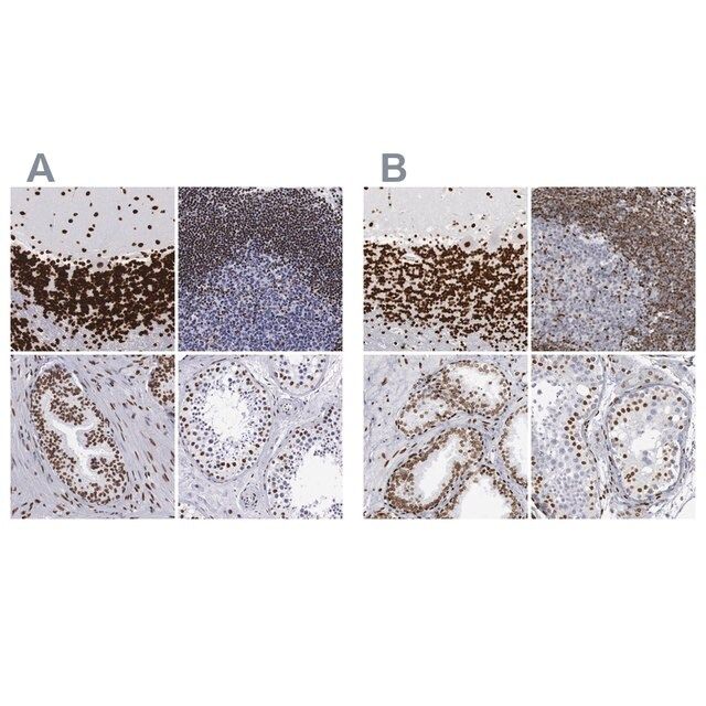 Anti-MeCP2 antibody produced in rabbit