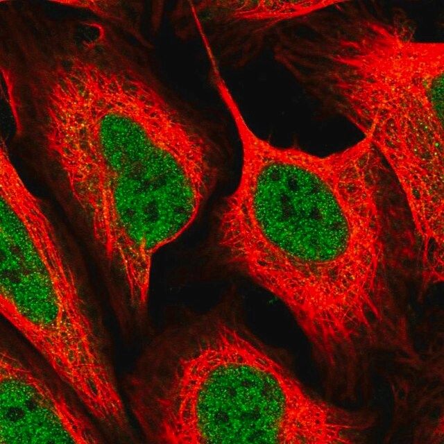 Anti-MED6 antibody produced in rabbit