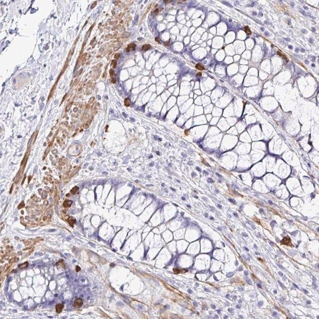 Anti-MED11 antibody produced in rabbit